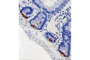 Immunohistochemical analysis of paraffin-embedded R. (LYZ Antikörper  (C-Term))