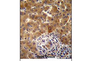 PHF17 Antibody (N-term) (ABIN657355 and ABIN2846405) immunohistochemistry analysis in formalin fixed and paraffin embedded human liver tissue followed by peroxidase conjugation of the secondary antibody and DAB staining. (PHF17 Antikörper  (N-Term))