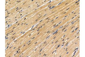 ABIN6256860 and ABIN6274329 at 1/100 staining Rat heart tissue by IHC-P. (FOXC1 Antikörper  (Internal Region))