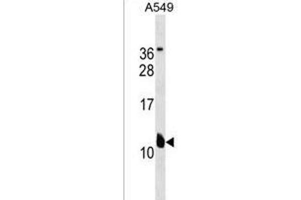 KCNE2 antibody  (C-Term)