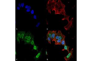 Immunocytochemistry/Immunofluorescence analysis using Mouse Anti-mGluR1/5 Monoclonal Antibody, Clone S75-33 . (Metabotropic Glutamate Receptor 5 Antikörper  (AA 824-1203) (Atto 488))