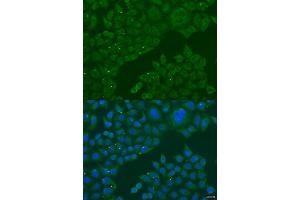 Immunofluorescence analysis of U2OS cells using B3GALNT1 antibody (ABIN2736338) at dilution of 1:100. (B3GALNT1 Antikörper)