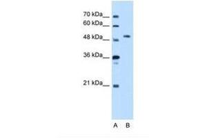 Image no. 1 for anti-serine threonine Kinase 39 (STK39) (AA 151-200) antibody (ABIN321508) (STK39 Antikörper  (AA 151-200))