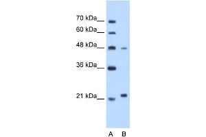 WB Suggested Anti-MMP1 Antibody Titration:  1. (MMP1 Antikörper  (N-Term))
