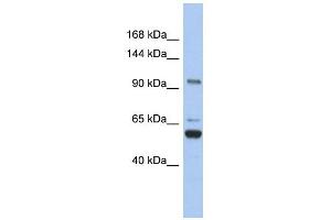 TRPM8 antibody used at 1 ug/ml to detect target protein. (TRPM8 Antikörper  (N-Term))