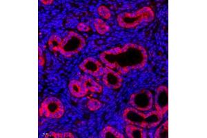 Immunofluorescence of paraffin embedded mouse uterus using CK13 (ABIN7074411) at dilution of 1:500 (400x lens) (Cytokeratin 13 Antikörper  (C-Term))