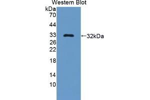 Detection of Recombinant Bcl11A, Human using Polyclonal Antibody to B-Cell CLL/Lymphoma 11A (Bcl11A) (BCL11A Antikörper  (AA 1-210))