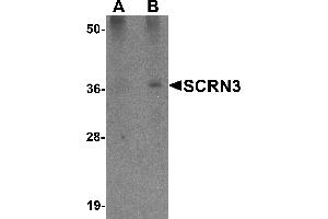 Western Blotting (WB) image for anti-Secernin 3 (SCRN3) (Middle Region) antibody (ABIN1031081) (Secernin 3 Antikörper  (Middle Region))