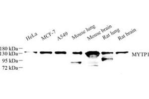Western blot analysis of MYTP1 (ABIN7074731) at dilution of 1: 500 (Myosin Binding Subunit Antikörper)