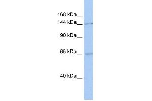 WB Suggested Anti-SMC1A Antibody Titration:  0. (SMC1A Antikörper  (C-Term))