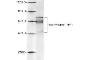 Western blot analysis of rat brain lysates using 1 µg/mL Antibodies-Online Rabbit Anti-Tau (Phospho-Thr217) Polyclonal Antibody (ABIN398308) The signal was developed with IRDyeTM 800 Conjugated Goat Anti-Rabbit IgG. (tau Antikörper  (pThr217))