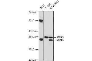 Western blot analysis of extracts of various cell lines, using STING antibody (ABIN7270958) at 1:1000 dilution. (STING/TMEM173 Antikörper)