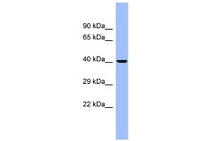 WB Suggested Anti-CEACAM6 Antibody Titration:  0. (CEACAM6 Antikörper  (N-Term))