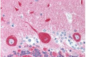 Human Brain, Cerebellum (formalin-fixed, paraffin-embedded) stained with FREQ antibody ABIN214036 at 5 ug/ml followed by biotinylated goat anti-rabbit IgG secondary antibody ABIN481713, alkaline phosphatase-streptavidin and chromogen. (NCS1 Antikörper)