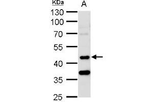 WB Image STK24 antibody [N2C1], Internal detects STK24 protein by western blot analysis. (STK24 Antikörper)