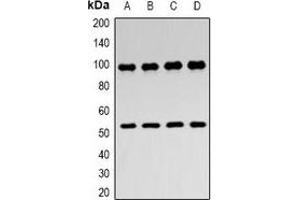 Western blot analysis of ZASP expression in Hela (A), MCF7 (B), mouse skeletal muscle (C), rat skeletal muscle (D) whole cell lysates. (LIM Domain Binding 3 Protein Antikörper)