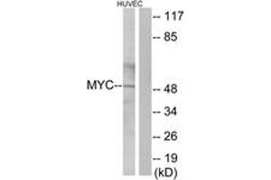 Western blot analysis of extracts from HuvEc cells, using MYC Antibody. (c-MYC Antikörper  (AA 386-435))