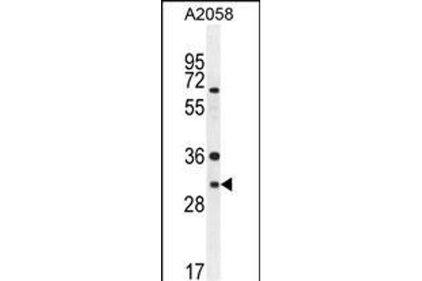 ARV1 Antikörper  (N-Term)