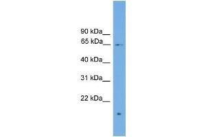 Human MCF-7; WB Suggested Anti-ZNF320 Antibody Titration: 0. (ZNF320 Antikörper  (N-Term))