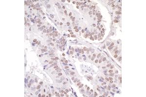 Immunohistochemistry (IHC) image for anti-PYD (Pyrin Domain) Containing 1 (PYDC1) (AA 1050-1100) antibody (ABIN7454625) (PYDC1 Antikörper  (AA 1050-1100))