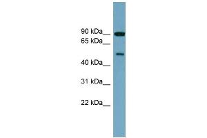 WB Suggested Anti-PI4K2B Antibody Titration: 0. (PI4K2B Antikörper  (Middle Region))