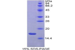 SDS-PAGE analysis of Mouse Gastrokine 3 Protein. (Gastrokine 3 Protein (GKN3))