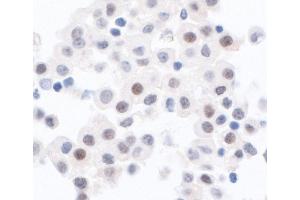 anti-Protein Phosphatase 1, Catalytic Subunit, alpha Isoform (PPP1CA) (C-Term) antibody