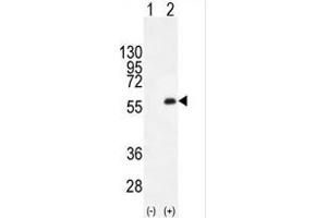Western blot analysis of PKMYT1 (arrow) using rabbit polyclonal PKMYT1 C-term (ABIN391292 and ABIN2841332). (PKMYT1 Antikörper  (C-Term))