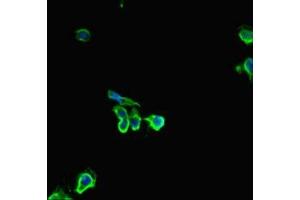 Immunofluorescent analysis of Hela cells using ABIN7154818 at dilution of 1:100 and Alexa Fluor 488-congugated AffiniPure Goat Anti-Rabbit IgG(H+L) (HDHD2 Antikörper  (AA 97-249))