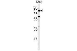 Western blot analysis of ACBG2 Antibody (Center) in K562 cell line lysates (35ug/lane). (ACSBG2 Antikörper  (Middle Region))