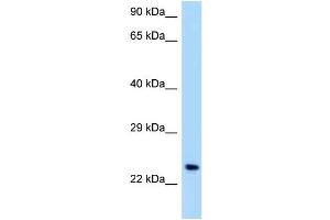 WB Suggested Anti-OSCAR Antibody Titration: 1. (OSCAR Antikörper  (C-Term))