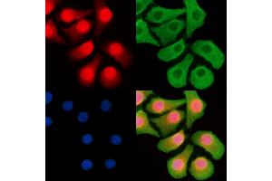 ABIN6263498 and ABIN6268752 staining Hela cells by IF/ICC. (MYCN Antikörper  (Internal Region))
