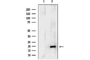 anti-Hippocalcin (HPCA) (Internal Region) antibody