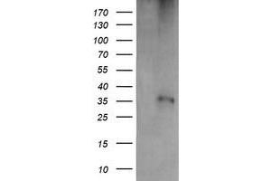 Western Blotting (WB) image for anti-T-cell surface glycoprotein CD1c (CD1C) antibody (ABIN1497187) (CD1c Antikörper)