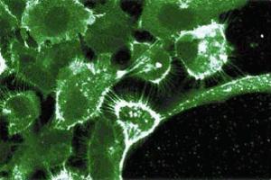 Immunofluroescent staining on A431 cells. (EGFR Antikörper  (AA 1020-1046))