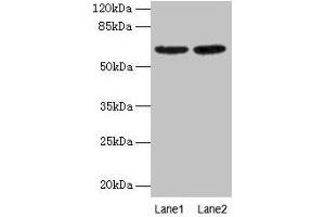 Western Blot All lanes: NELFB antibody at 2 μg/mL Lane 1: NIH/3T3 whole cell lysate Lane 2: HL60 whole cell lysate Secondary Goat polyclonal to rabbit IgG at 1/15000 dilution Predicted band size: 66 kDa Observed band size: 66 kDa (COBRA1 Antikörper  (AA 8-199))