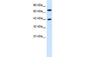 WB Suggested Anti-C20ORF100 Antibody Titration: 0. (TOX2 Antikörper  (N-Term))