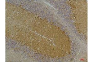 Immunohistochemical analysis of paraffin-embedded Rat BrainTissue using KCNN3(SK3) Rabbit pAb diluted at 1:200.