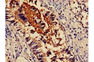Immunohistochemistry of paraffin-embedded human lung tissue using ABIN7143831 at dilution of 1:100 (alpha Actinin 4 Antikörper  (AA 6-277))