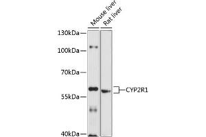 Western blot analysis of extracts of various cell lines, using CYP2R1 antibody (ABIN6130162, ABIN6139341, ABIN6139342 and ABIN6214739) at 1:1000 dilution. (CYP2R1 Antikörper  (AA 252-501))
