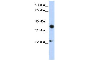 EN1 antibody used at 1 ug/ml to detect target protein. (EN1 Antikörper  (C-Term))