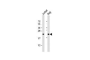 All lanes : Anti-CBFB Antibody (Center) at 1:1000 dilution Lane 1: Jurkat whole cell lysate Lane 2: Raji whole cell lysate Lysates/proteins at 20 μg per lane. (CBFB Antikörper  (AA 61-90))