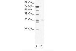 Image no. 1 for anti-LIM Homeobox 3 (LHX3) (AA 230-279) antibody (ABIN203106) (LHX3 Antikörper  (AA 230-279))