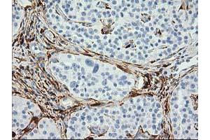 Image no. 4 for anti-Alcohol Dehydrogenase 1B (Class I), beta Polypeptide (ADH1B) antibody (ABIN1496479) (ADH1B Antikörper)