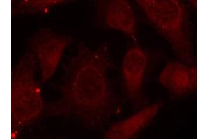 Immunofluorescence staining of methanol-fixed Hela cells using Phospho-NF2-S518 antibody. (Merlin Antikörper  (pSer518))