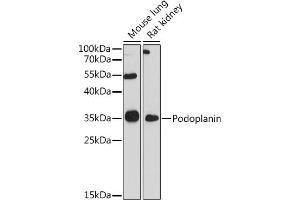 Western blot analysis of extracts of various cell lines, using Podoplanin antibody (ABIN6128559, ABIN6145406, ABIN6145409 and ABIN6217196) at 1:1000 dilution. (Podoplanin Antikörper)
