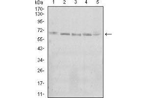 Western blot analysis using KBTBD8 mouse mAb against A431 (1), Jurkat (2), Hela (3), K562 (4), and HEK293 (5) cell lysate. (KBTBD8 Antikörper  (AA 264-464))