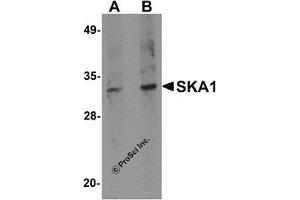 Western Blotting (WB) image for anti-Spindle and Kinetochore Associated Complex Subunit 1 (SKA1) (C-Term) antibody (ABIN1030667) (SKA1 Antikörper  (C-Term))