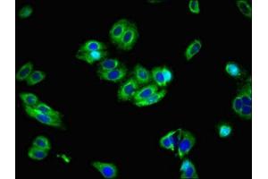 Immunofluorescence (IF) image for anti-Solute Carrier Family 39 (Zinc Transporter), Member 8 (SLC39A8) (AA 30-132) antibody (ABIN7176714)