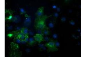 Anti-PDE2A mouse monoclonal antibody (ABIN2454178) immunofluorescent staining of COS7 cells transiently transfected by pCMV6-ENTRY PDE2A (RC207219). (PDE2A Antikörper)